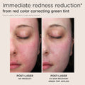 Immediate redness reduction - from red color correcting green tint Product Image 7